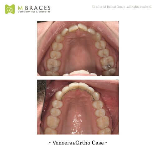 Dental Case Format (1)