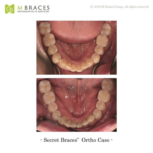 Dental Case Format (11)