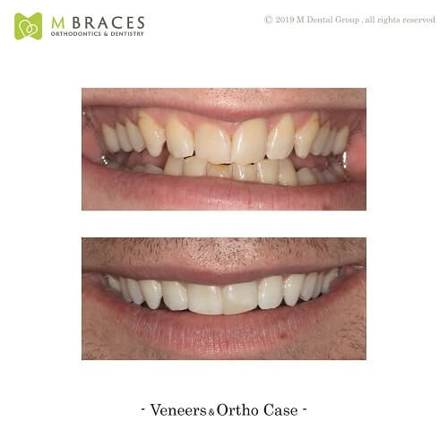 Dental Case Format (2)