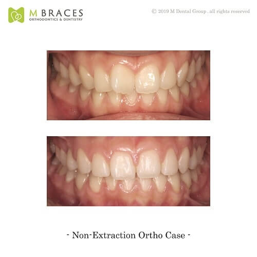 Dental Case Format (3)