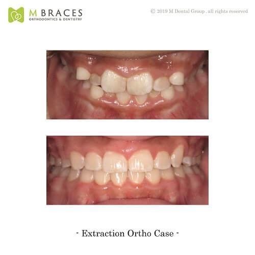 Dental Case Format (6)