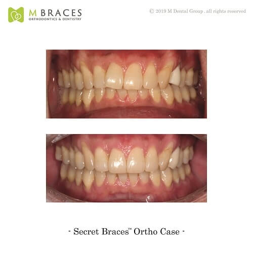 Dental Case Format (9)